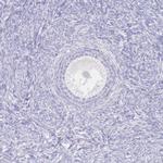 IMPG1 Antibody in Immunohistochemistry (IHC)