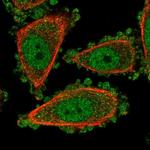 UROD Polyclonal Antibody