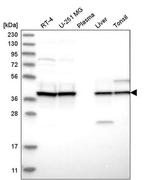 UROD Antibody in Western Blot (WB)