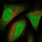 RHBDL1 Polyclonal Antibody