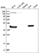 RHBDL1 Antibody in Western Blot (WB)