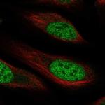 RHBDL1 Polyclonal Antibody