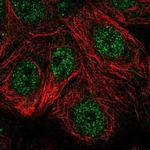 TSPAN17 Polyclonal Antibody