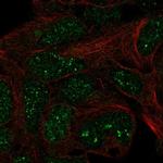 TRMT11 Polyclonal Antibody