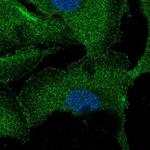 ZNF785 Polyclonal Antibody