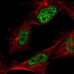 C1orf77 Polyclonal Antibody