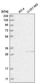 C1orf77 Antibody in Western Blot (WB)