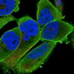 PALMD Polyclonal Antibody