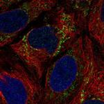 C1orf69 Polyclonal Antibody