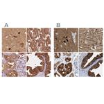 CRYM Antibody in Immunohistochemistry (IHC)