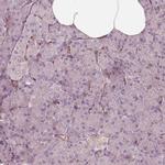 CRYM Antibody in Immunohistochemistry (IHC)