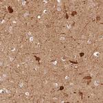 CRYM Antibody in Immunohistochemistry (IHC)