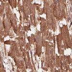 CRYM Antibody in Immunohistochemistry (IHC)