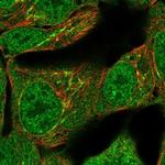 TNFAIP2 Polyclonal Antibody