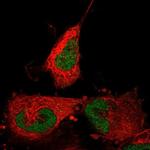ABTB2 Polyclonal Antibody