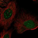 ZNF771 Polyclonal Antibody