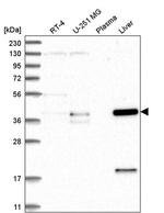 ZNF771 Antibody in Western Blot (WB)