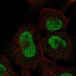 ZNF667 Polyclonal Antibody