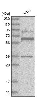ZNF667 Antibody in Western Blot (WB)