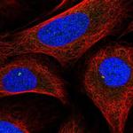 DDX26B Polyclonal Antibody