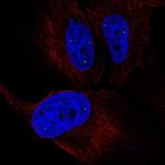 ZNF239 Polyclonal Antibody