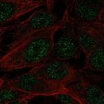 SPATS1 Polyclonal Antibody