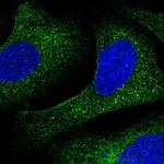 LZIP Polyclonal Antibody