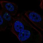 PMS1 Polyclonal Antibody