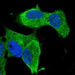 ZNF117 Polyclonal Antibody