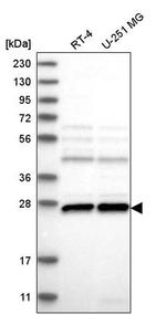 C1orf216 Antibody in Western Blot (WB)