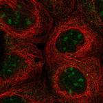 UBXD5 Polyclonal Antibody