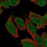 SHC3 Polyclonal Antibody