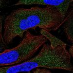 MOV10 Polyclonal Antibody