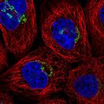 RINT1 Polyclonal Antibody