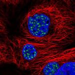 SON Polyclonal Antibody