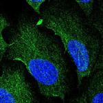 AAMP Polyclonal Antibody