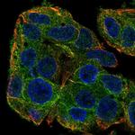 SLC38A3 Polyclonal Antibody