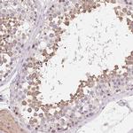 LCA5L Antibody in Immunohistochemistry (IHC)