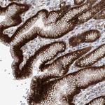 KIAA1522 Antibody in Immunohistochemistry (IHC)