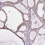 MYO5C Polyclonal Antibody