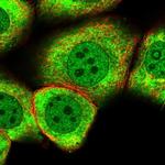 MYO5C Polyclonal Antibody