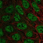 EXOC6B Polyclonal Antibody