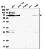 EXOC6B Antibody in Western Blot (WB)