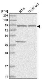 FAM184A Antibody in Western Blot (WB)