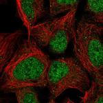 PMF1 Polyclonal Antibody