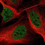 ASXL2 Polyclonal Antibody