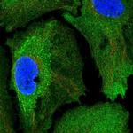 SSFA2 Polyclonal Antibody