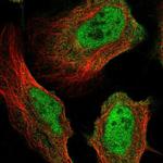 MICAL3 Polyclonal Antibody