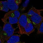 FAM26E Polyclonal Antibody