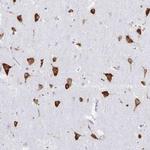 PACT Antibody in Immunohistochemistry (IHC)